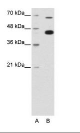 ZBTB33 / Kaiso Antibody - A: Marker, B: HepG2 Cell Lysate.  This image was taken for the unconjugated form of this product. Other forms have not been tested.