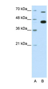 ZBTB33 / Kaiso Antibody - ZBTB33 / Kaiso antibody Western blot of HepG2 cell lysate. This image was taken for the unconjugated form of this product. Other forms have not been tested.
