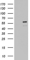 ZBTB37 Antibody - HEK293T cells were transfected with the pCMV6-ENTRY control (Left lane) or pCMV6-ENTRY ZBTB37 (Right lane) cDNA for 48 hrs and lysed. Equivalent amounts of cell lysates (5 ug per lane) were separated by SDS-PAGE and immunoblotted with anti-ZBTB37.