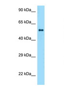 ZBTB37 Antibody - ZBTB37 antibody Western blot of Mouse Spleen lysate. Antibody concentration 1 ug/ml.  This image was taken for the unconjugated form of this product. Other forms have not been tested.