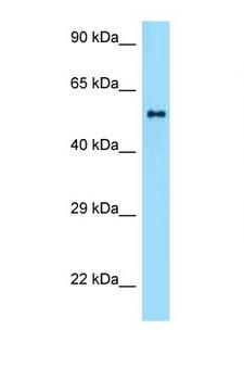 ZBTB37 Antibody - ZBTB37 antibody Western blot of Mouse Spleen lysate. Antibody concentration 1 ug/ml.  This image was taken for the unconjugated form of this product. Other forms have not been tested.