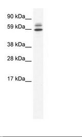 ZBTB38 Antibody - SP2/0 Cell Lysate.  This image was taken for the unconjugated form of this product. Other forms have not been tested.
