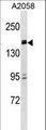 ZBTB38 Antibody - ZBTB38 Antibody western blot of A2058 cell line lysates (35 ug/lane). The ZBTB38 antibody detected the ZBTB38 protein (arrow).