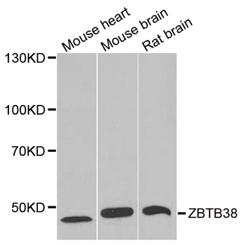 ZBTB38 Antibody - Western blot analysis of extracts of various tissues.
