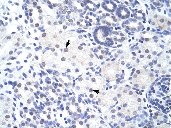 ZBTB38 Antibody - ZBTB38 antibody ARP40114_T100-XP_001133510-ZBTB38 (zinc finger and BTB domain containing 38) Antibody was used in IHC to stain formalin-fixed, paraffin-embedded human kidney.  This image was taken for the unconjugated form of this product. Other forms have not been tested.