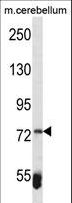 ZBTB39 Antibody - ZBTB39 Antibody western blot of mouse cerebellum tissue lysates (35 ug/lane). The ZBTB39 Antibody detected the ZBTB39 protein (arrow).