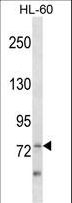 ZBTB39 Antibody - ZBTB39 Antibody western blot of HL-60 cell line lysates (35 ug/lane). The ZBTB39 Antibody detected the ZBTB39 protein (arrow).