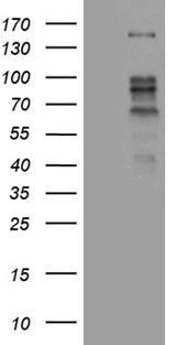 ZBTB4 Antibody - HEK293T cells were transfected with the pCMV6-ENTRY control. (Left lane) or pCMV6-ENTRY ZBTB4. (Right lane) cDNA for 48 hrs and lysed. Equivalent amounts of cell lysates. (5 ug per lane) were separated by SDS-PAGE and immunoblotted with anti-ZBTB4. (1:500)