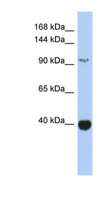 ZBTB4 Antibody - ZBTB4 antibody Western blot of Fetal Spleen lysate. This image was taken for the unconjugated form of this product. Other forms have not been tested.
