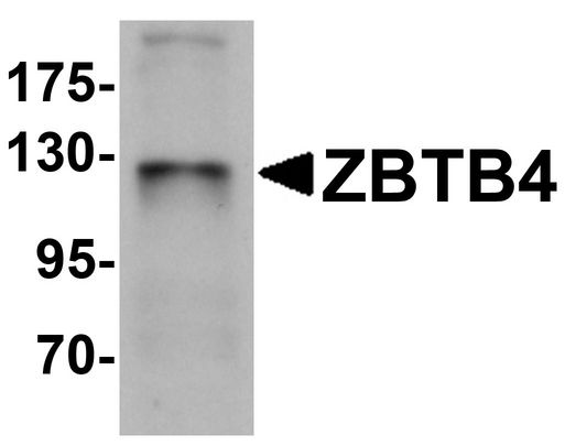ZBTB4 Antibody - Western blot analysis of ZBTB4 in SK-N-SH cell lysate with ZBTB4 antibody at 1 ug/ml.