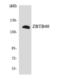ZBTB40 Antibody - Western blot analysis of the lysates from HUVECcells using ZBTB40 antibody.