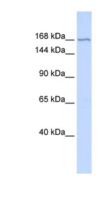 ZBTB40 Antibody - ZBTB40 antibody Western blot of Fetal Liver lysate. This image was taken for the unconjugated form of this product. Other forms have not been tested.
