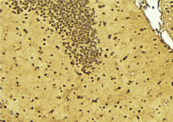 ZBTB40 Antibody - 1:100 staining mouse brain tissue by IHC-P. The sample was formaldehyde fixed and a heat mediated antigen retrieval step in citrate buffer was performed. The sample was then blocked and incubated with the antibody for 1.5 hours at 22°C. An HRP conjugated goat anti-rabbit antibody was used as the secondary.