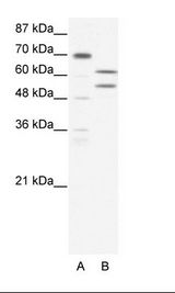 ZBTB43 Antibody - A: Marker, B: HepG2 Cell Lysate.  This image was taken for the unconjugated form of this product. Other forms have not been tested.