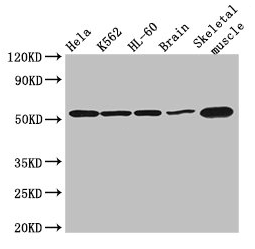 ZBTB43 Antibody - Western Blot Positive WB detected in: Hela whole cell lysate, K562 whole cell lysate, HL60 whole cell lysate, Mouse brain tissue, Mouse skeletal muscle tissue All lanes: ZBTB43 antibody at 3µg/ml Secondary Goat polyclonal to rabbit IgG at 1/50000 dilution Predicted band size: 53 kDa Observed band size: 53 kDa