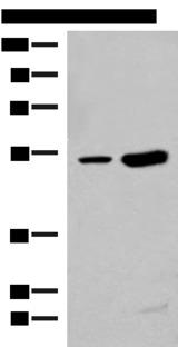 ZBTB43 Antibody - Western blot analysis of Human left thymus tissue and Mouse kidney tissue lysates  using ZBTB43 Polyclonal Antibody at dilution of 1:250