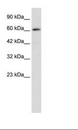 ZBTB45 Antibody - Jurkat Cell Lysate.  This image was taken for the unconjugated form of this product. Other forms have not been tested.