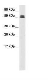 ZBTB45 Antibody - Fetal Lung Lysate.  This image was taken for the unconjugated form of this product. Other forms have not been tested.