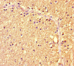 ZBTB46 Antibody - Immunohistochemistry of paraffin-embedded human brain tissue at dilution of 1:100