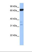 ZBTB46 Antibody - Placenta cell lysate. Antibody concentration: 1.0 ug/ml. Gel concentration: 12%.  This image was taken for the unconjugated form of this product. Other forms have not been tested.