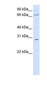 ZBTB48 / HKR3 Antibody - ZBTB48 antibody Western blot of 293T cell lysate. This image was taken for the unconjugated form of this product. Other forms have not been tested.