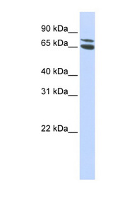 ZBTB48 / HKR3 Antibody - ZBTB48 antibody Western blot of HepG2 cell lysate. This image was taken for the unconjugated form of this product. Other forms have not been tested.
