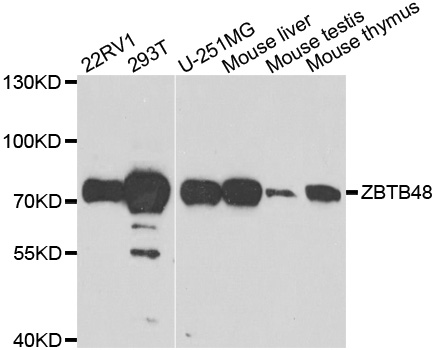 ZBTB48 / HKR3 Antibody - Western blot analysis of extracts of various cell lines.