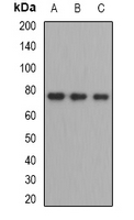 ZBTB48 / HKR3 Antibody - Western blot analysis of ZBTB48 expression in HEK293T (A); mouse liver (B); mouse testis (C) whole cell lysates.