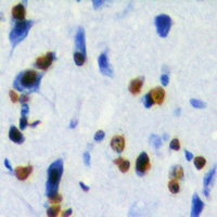 ZBTB48 / HKR3 Antibody - Immunohistochemical analysis of ZBTB48 staining in human brain formalin fixed paraffin embedded tissue section. The section was pre-treated using heat mediated antigen retrieval with sodium citrate buffer (pH 6.0). The section was then incubated with the antibody at room temperature and detected using an HRP conjugated compact polymer system. DAB was used as the chromogen. The section was then counterstained with hematoxylin and mounted with DPX.