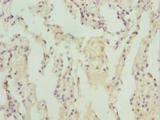 ZBTB48 / HKR3 Antibody - Immunohistochemistry of paraffin-embedded human lung tissue at dilution 1:100
