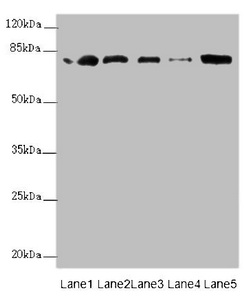 ZBTB48 / HKR3 Antibody - Western blot All Lanes:ZBTB48 antibody at 0.31ug/ml Lane 1 : 293T whole cell lysate Lane 2 : K562 whole cell lysate Lane 3 : HepG-2 whole cell lysate Lane 4 : U251 whole cell lysate Lane 5 : Mouse liver tissue Secondary Goat polyclonal to Rabbit IgG at 1/10000 dilution Predicted band size: 77 kDa Observed band size: 77 kDa