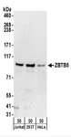ZBTB5 Antibody - Detection of Human ZBTB5 by Western Blot. Samples: Whole cell lysate (50 ug) from Jurkat, 293T, and HeLa cells. Antibodies: Affinity purified rabbit anti-ZBTB5 antibody used for WB at 0.1 ug/ml. Detection: Chemiluminescence with an exposure time of 3 minutes.