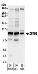 ZBTB5 Antibody - Detection of Human ZBTB5 by Western Blot. Samples: Whole cell lysate (50 ug) from Jurkat, 293T, and HeLa cells. Antibodies: Affinity purified rabbit anti-ZBTB5 antibody used for WB at 0.1 ug/ml. Detection: Chemiluminescence with an exposure time of 30 seconds.