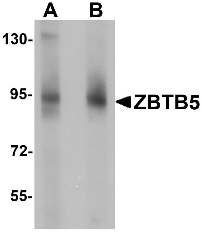 ZBTB5 Antibody - Western blot analysis of ZBTB5 in mouse brain tissue lysate with ZBTB5 antibody at (A) 1 and (B) 2 ug/ml.