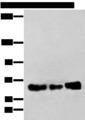 ZBTB5 Antibody - Western blot analysis of TM4 K562 and A431 cell lysates  using ZBTB5 Polyclonal Antibody at dilution of 1:250