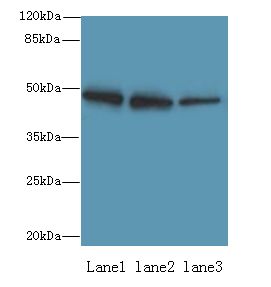 ZBTB6 Antibody - Western blot. All lanes: ZBTB6 antibody at 8 ug/ml. Lane 1: HeLa whole cell lysate. Lane 2: HepG-2 whole cell lysate. Lane 3: 293T whole cell lysate. Secondary antibody: Goat polyclonal to Rabbit IgG at 1:10000 dilution. Predicted band size: 48 kDa. Observed band size: 48 kDa.