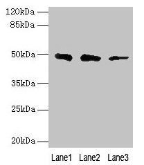 ZBTB6 Antibody - Western blot All lanes: ZBTB6 antibody at 8µg/ml Lane 1: Hela whole cell lysate Lane 2: HepG2 whole cell lysate Lane 3: 293T whole cell lysate Secondary Goat polyclonal to rabbit IgG at 1/10000 dilution Predicted band size: 48 kDa Observed band size: 48 kDa