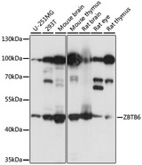 ZBTB6 Antibody - Western blot analysis of extracts of various cell lines, using ZBTB6 antibody at 1:1000 dilution. The secondary antibody used was an HRP Goat Anti-Rabbit IgG (H+L) at 1:10000 dilution. Lysates were loaded 25ug per lane and 3% nonfat dry milk in TBST was used for blocking. An ECL Kit was used for detection and the exposure time was 5s.