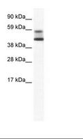 ZBTB7A / Pokemon Antibody - NIH 3T3 Cell Lysate.  This image was taken for the unconjugated form of this product. Other forms have not been tested.
