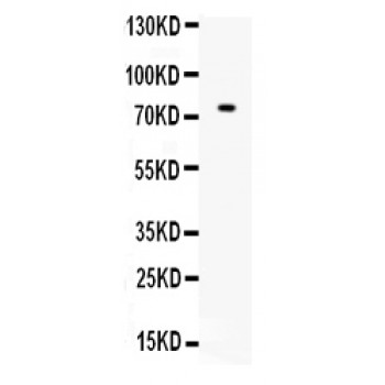 ZBTB7A / Pokemon Antibody - Western blot analysis of ZBTB7A expression in HELA whole cell lysates (lane 1). ZBTB7A at 75 kD was detected using rabbit anti- ZBTB7A Antigen Affinity purified polyclonal antibody at 0.5 ug/mL. The blot was developed using chemiluminescence (ECL) method.