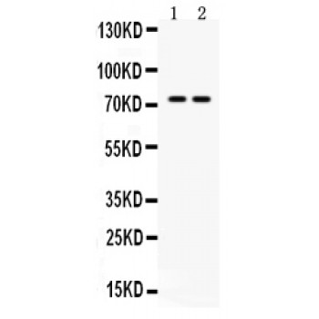 ZBTB7A / Pokemon Antibody - Western blot analysis of ZBTB7A expression in mouse kidney extract (lane 1) and NIH3T3 whole cell lysates (lane 2). ZBTB7A at 75 kD was detected using rabbit anti- ZBTB7A Antigen Affinity purified polyclonal antibody at 0.5 ug/mL. The blot was developed using chemiluminescence (ECL) method.