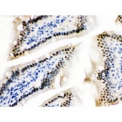 ZBTB7A / Pokemon Antibody - ZBTB7A was detected in paraffin-embedded sections of mouse intestine tissues using rabbit anti- ZBTB7A Antigen Affinity purified polyclonal antibody at 1 ug/mL. The immunohistochemical section was developed using SABC method.