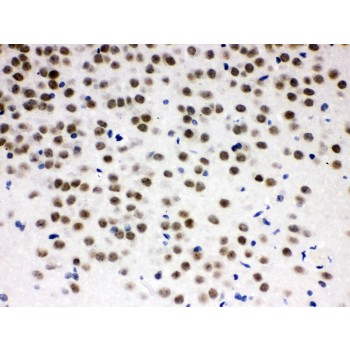 ZBTB7A / Pokemon Antibody - ZBTB7A was detected in paraffin-embedded sections of rat brain tissues using rabbit anti- ZBTB7A Antigen Affinity purified polyclonal antibody at 1 ug/mL. The immunohistochemical section was developed using SABC method.