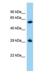 ZBTB7A / Pokemon Antibody - ZBTB7A / Pokemon antibody Western Blot of Mouse Pancreas.  This image was taken for the unconjugated form of this product. Other forms have not been tested.