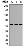 ZBTB7A / Pokemon Antibody - Western blot analysis of Pokemon expression in A549 (A); NS-1 (B); PC12 (C) whole cell lysates.