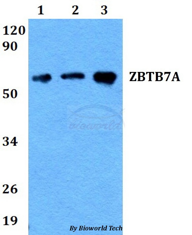ZBTB7A / Pokemon Antibody - Western blot of ZBTB7A antibody at 1:500 dilution. Lane 1: A549 whole cell lysate. Lane 2: sp2/0 whole cell lysate. Lane 3: PC12 whole cell lysate.