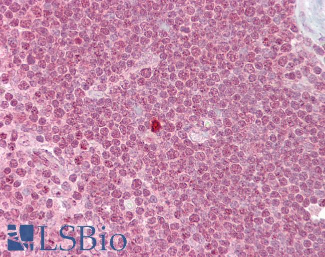 ZBTB7A / Pokemon Antibody - Anti-ZBTB7A antibody IHC of human thymus. Immunohistochemistry of formalin-fixed, paraffin-embedded tissue after heat-induced antigen retrieval. Antibody concentration 5 ug/ml.  This image was taken for the unconjugated form of this product. Other forms have not been tested.