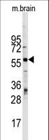 ZBTB7B / HcKrox Antibody - Western blot of ZBTB7B Antibody antibody in mouse brain tissue lysates (35 ug/lane). ZBTB7B (arrow) was detected using the purified antibody.