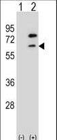 ZBTB7B / HcKrox Antibody - Western blot of ZBTB7B (arrow) using rabbit polyclonal ZBTB7B Antibody. 293 cell lysates (2 ug/lane) either nontransfected (Lane 1) or transiently transfected (Lane 2) with the ZBTB7B gene.