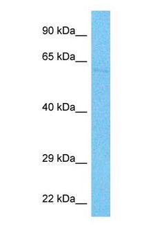 ZBTB7B / HcKrox Antibody - Western blot of ZBT7B Antibody with human HeLa Whole Cell lysate.  This image was taken for the unconjugated form of this product. Other forms have not been tested.